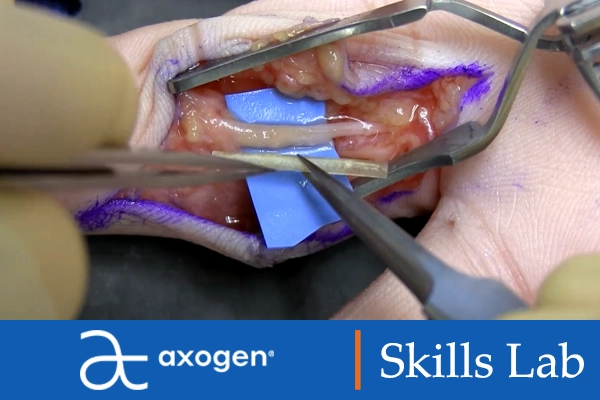 axogen skills lab image thumbnail